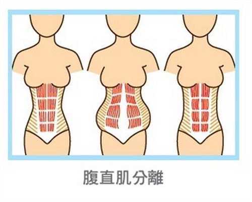 北京正规借腹生子助孕_孕妇的瑜伽动作示范