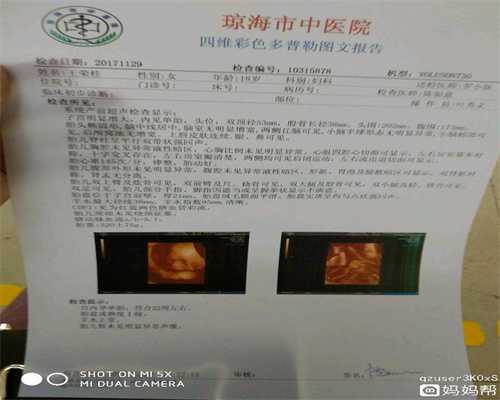 北京代孕选性别：北京代孕公司地址_北京代孕价格查询