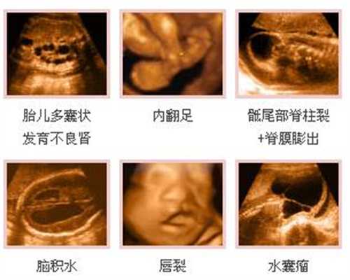 北京哪里有代孕中心_气管和食管的关系如何
