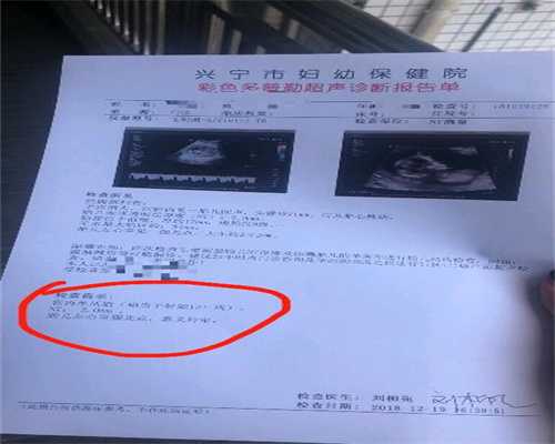 北京代孕医院费用_月经提前10多天正常吗
