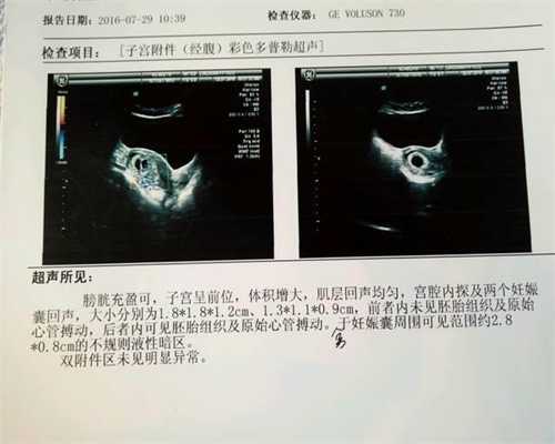 北京代孕医院怎么联系_宫外孕用测纸能测出怀孕吗