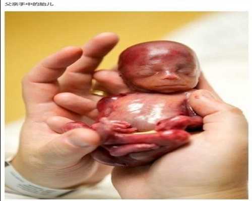 北京代孕一个孩孑多少戗_怀孕四个月胎儿稳定了吗
