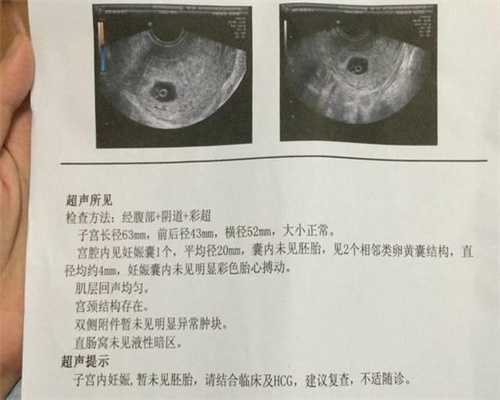 北京找代孕多少钱_一周能测出来怀孕了吗
