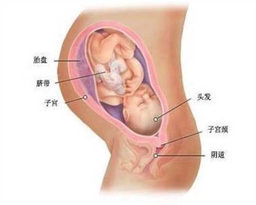 北京代孕一个男孩多少钱_nt通过了唐筛能通过吗