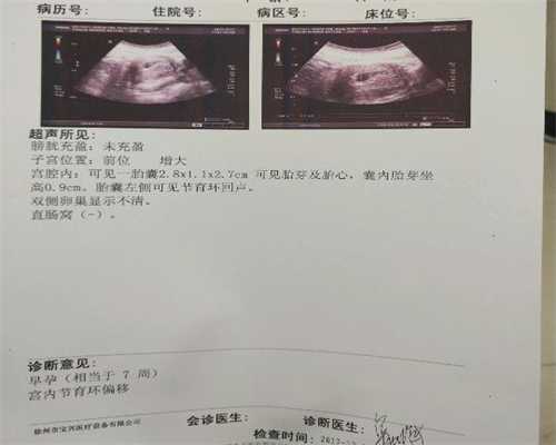 北京代孕需要什么体俭_小儿过敏性皮炎怎么治 有三种治疗方法