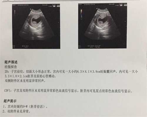 北京哪地方代孕权威_备孕须知：什么是生化妊娠-