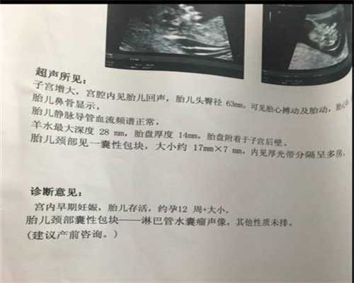 北京去哪里找代孕靠谱_早产儿黄疸怎么办，早产儿黄疸的症状