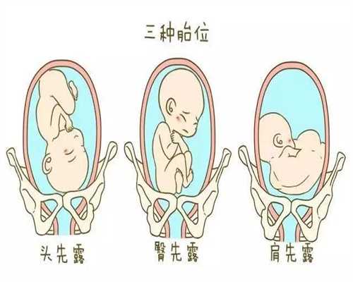 北京代孕那个较好_备孕期应该怎么穿衣？