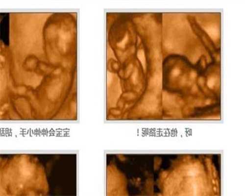 北京代孕公司排名_妊娠子痫产后婴儿护理，妊娠子痫产后注意事项