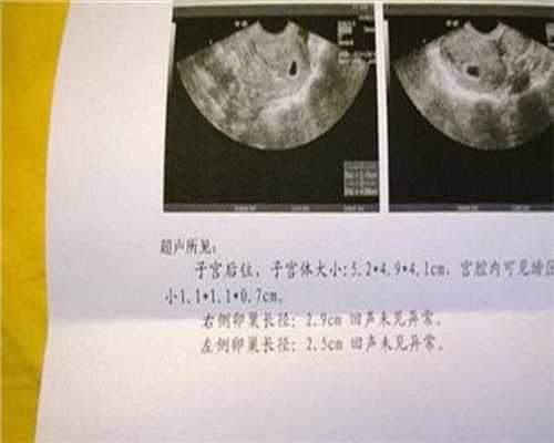 北京合法代孕一般多少钱_怀孕喝了啤酒有影响吗 孕期不能喝什么