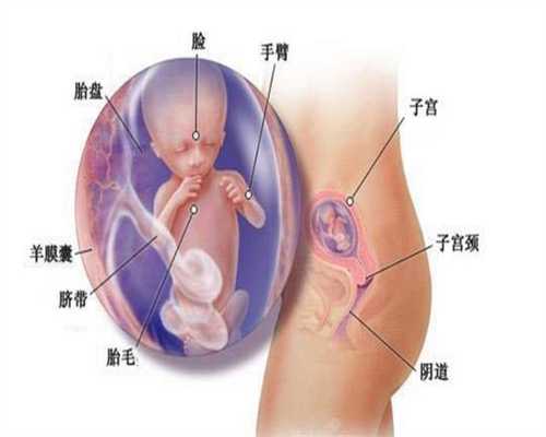 北京代孕套餐有哪些_进行人流对之后怀孕的影响