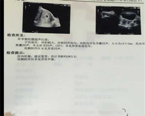 北京代孕风险有哪几项_孕妇能吃杏仁肉吗