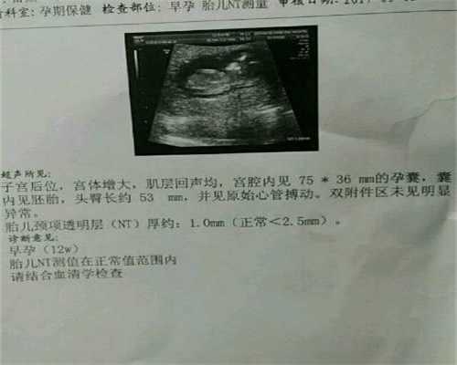 北京代孕公司价格_怀孕可以喝玉米汁吗 玉米对孕妇有影响吗