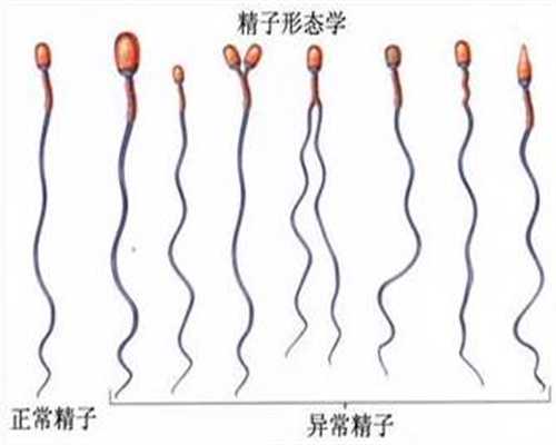 北京2020代孕费多少钱_宝宝夜醒的18种原因分别是什么？