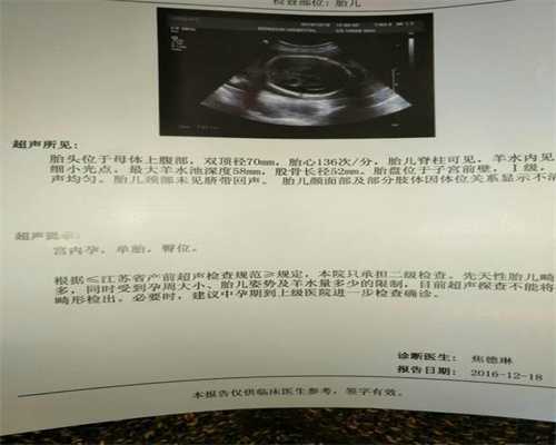 北京最新代孕产子价格_1个月宝宝睡觉不踏实的治疗方法