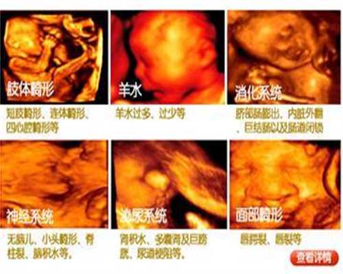 北京郝运助孕服务公司_顺转剖的定义，什么情况下要顺转剖