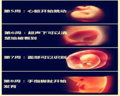 北京金宝宝助孕网_输卵管碘油造影检查怎么做呢