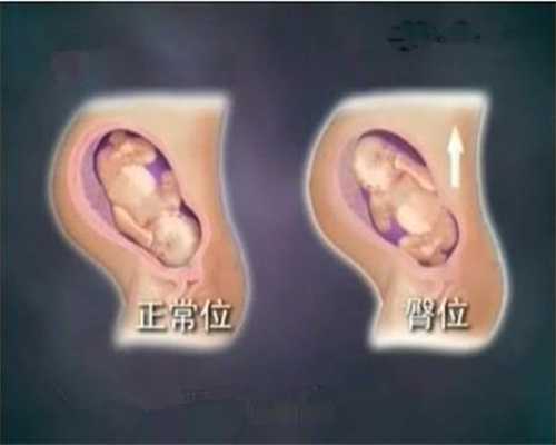 北京哪里代孕孩子便宜_30岁了怀不上孕怎么办