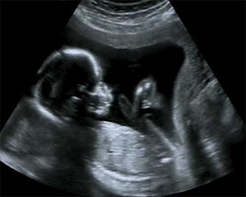 北京合法代孕~北京代孕市场调查~做一个北京人工代孕要多少钱
