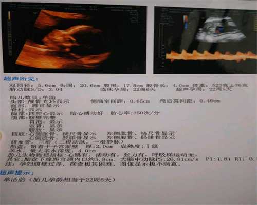 2020北京代孕：北京代孕电话_北京代怀孕需要多少钱