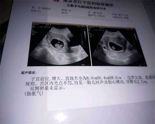 北京代孕试管助孕中心：北京代孕在哪里_北京代孕双胞胎包成功多少钱