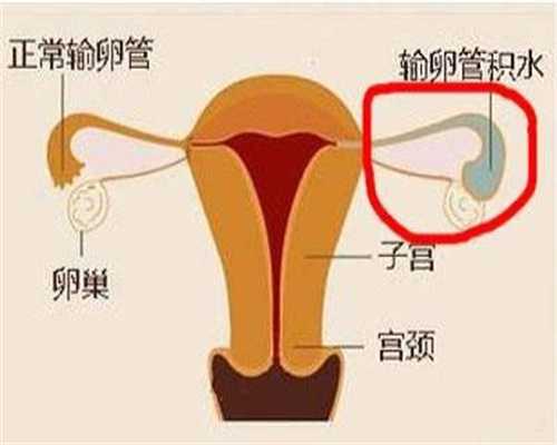 代孕成功的机率-北京借腹生子生殖中心选性别_北京晚报：欢呼“中地沟油”被