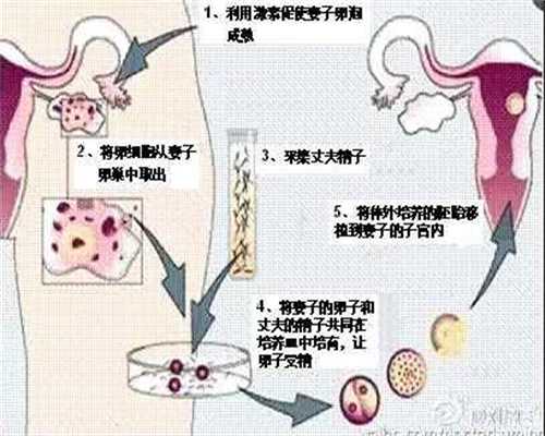 北京代孕产子技术顶尖-代孕男女选择_这位从北京来的医生，从脑情况就能看出