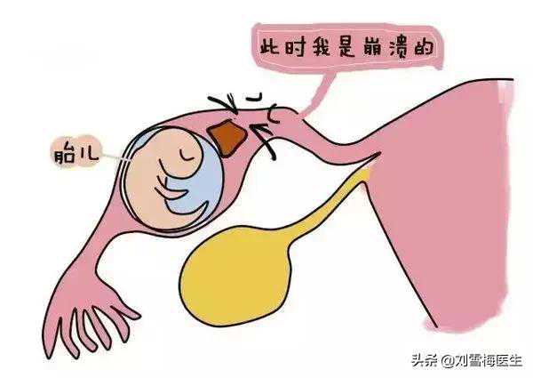 北京代怀孕优势-北京找代孕价格表-北京供卵试管排队要多久